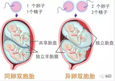 胎儿肤色形成的时间与过程解析