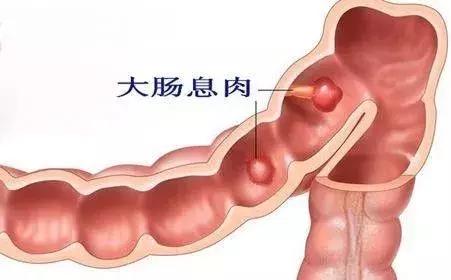 宝宝九个月便秘怎么办？全面解析与应对建议